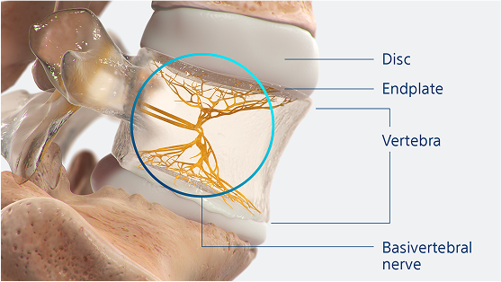 Illustration of vertebra and basivertebral nerve branches.