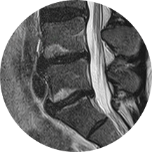 MRI of lower spine.